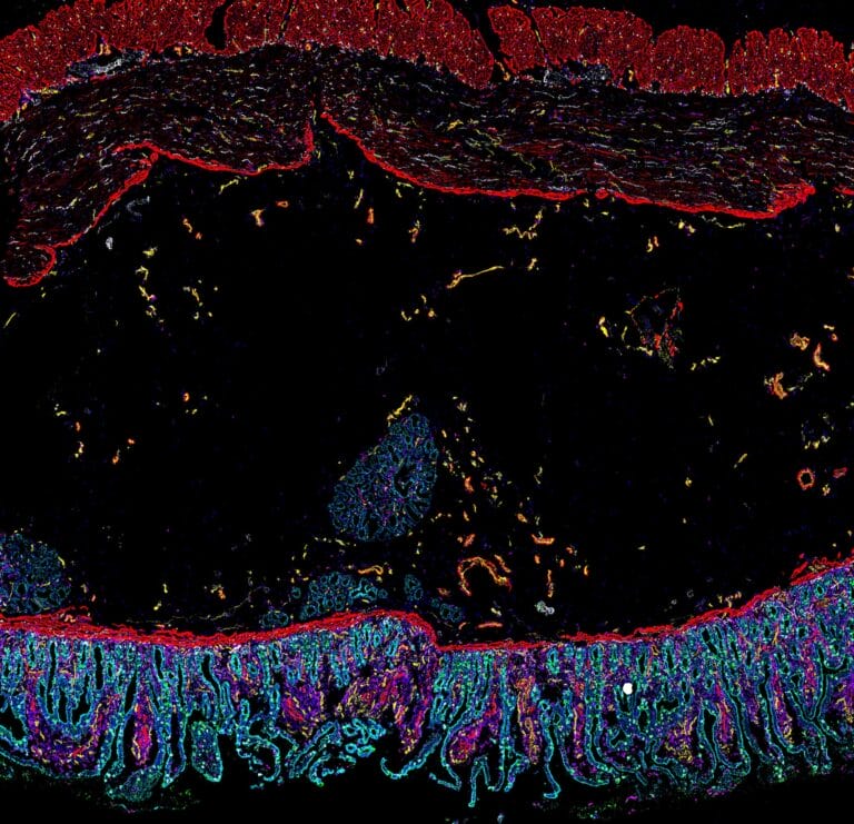 Computer-enhanced image of gut cells