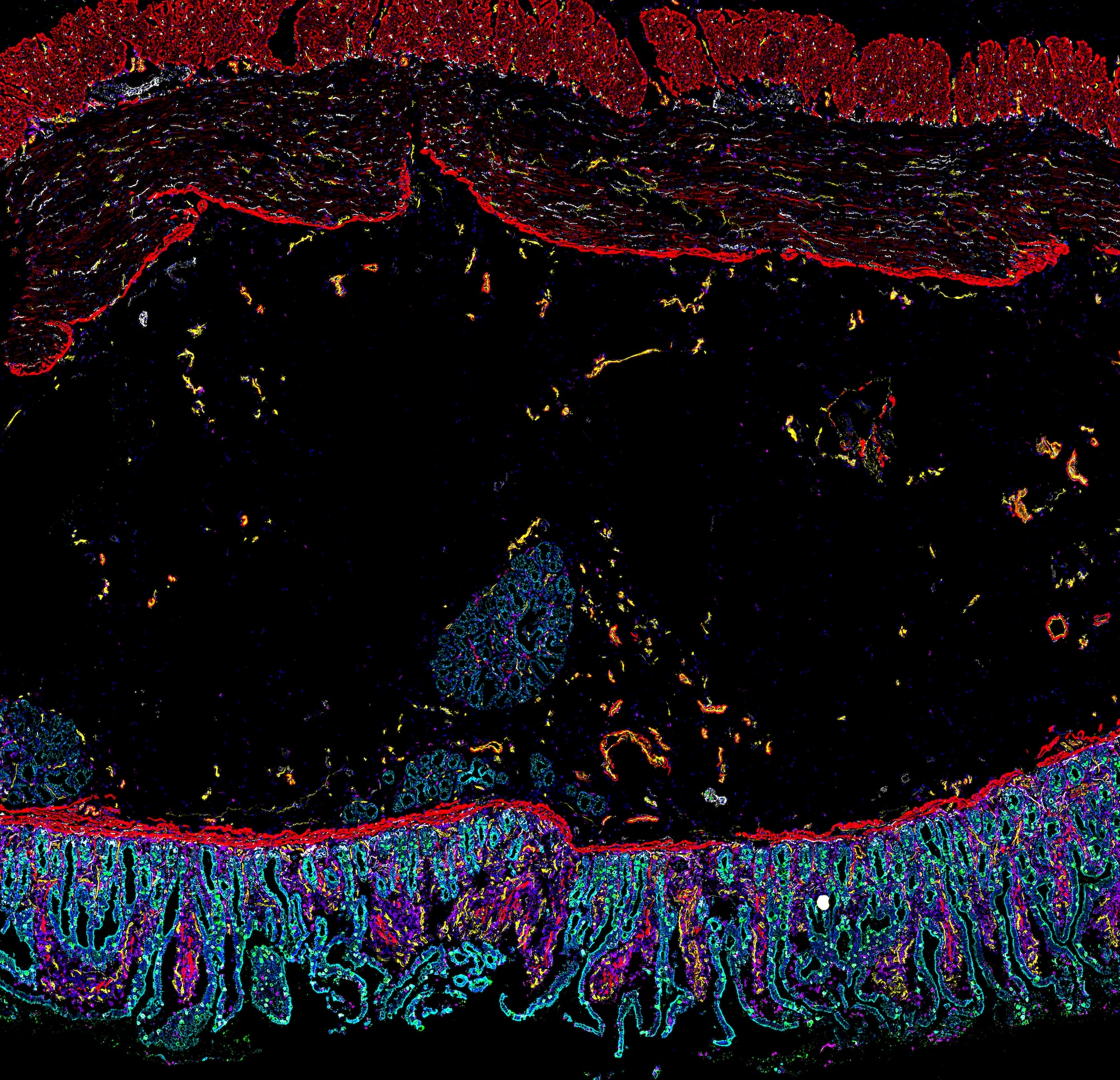 Computer-enhanced image of gut cells